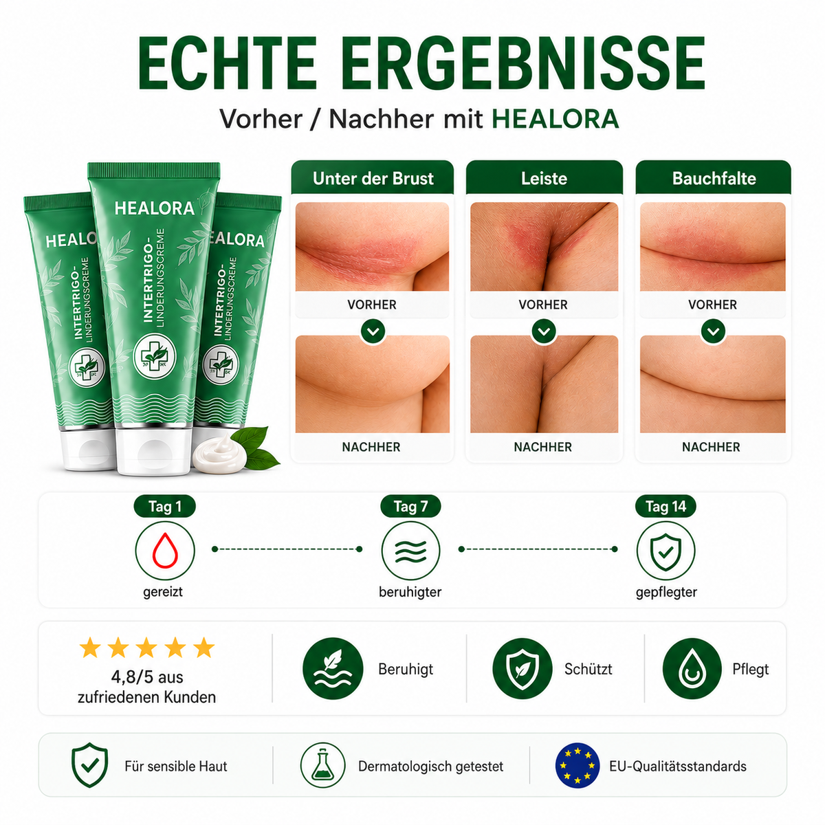 3× HEALORA™ Intertrigo-Linderungscreme – exklusives Zusatzangebot mit zusätzlichen 50 % Rabatt