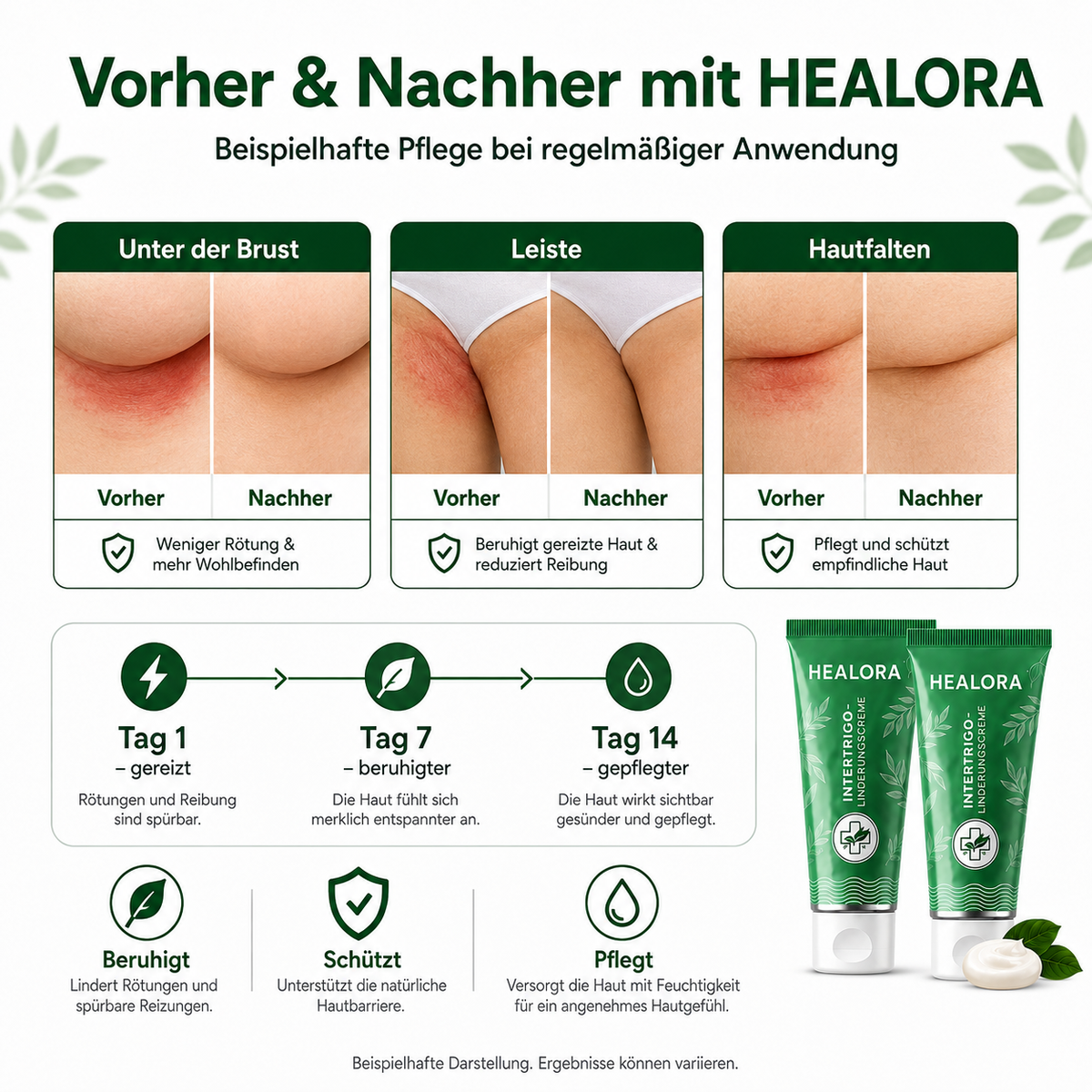 2× HEALORA™ Intertrigo-Linderungscreme – exklusives Zusatzangebot mit zusätzlichen 50 % Rabatt