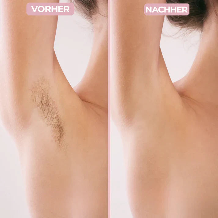 Kraftgang™ 2-in-1 Damen Körperrasierer
