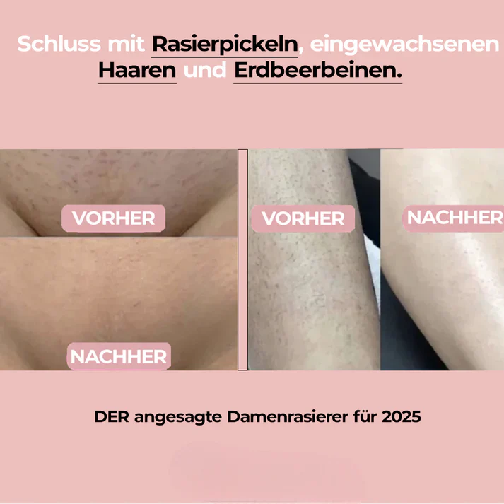 Kraftgang™ 2-in-1 Damen Körperrasierer