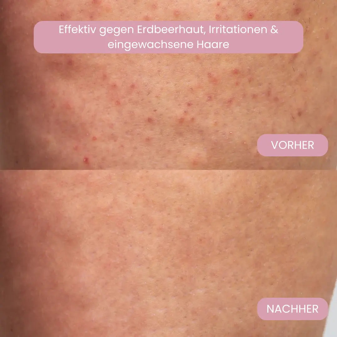 Glisse Pro Sommer-Starter-Set